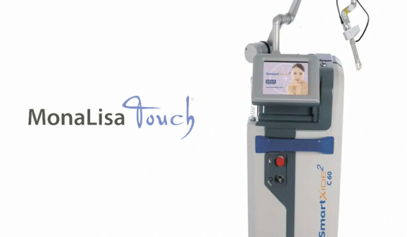 Lāzers sievietes intīmajam komfortam - MonaLisa Touch®